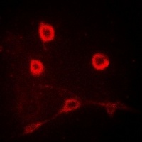 CD212 Rabbit Polyclonal Antibody