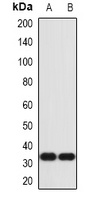 IL-1 alpha Rabbit Polyclonal Antibody