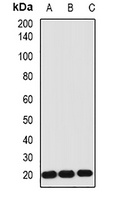 IL-1RA Rabbit Polyclonal Antibody