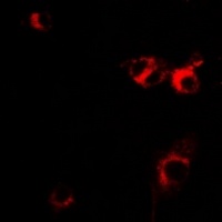 IL-1RA Rabbit Polyclonal Antibody