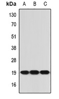 IL-21 Rabbit Polyclonal Antibody