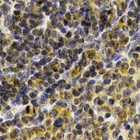 IL-21 Rabbit Polyclonal Antibody