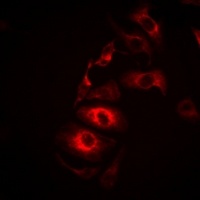 IL-21 Rabbit Polyclonal Antibody