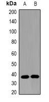 Omentin Rabbit Polyclonal Antibody
