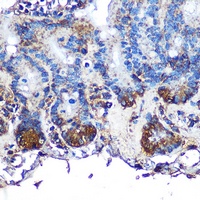 Omentin Rabbit Polyclonal Antibody