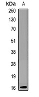 KCNE1 Rabbit Polyclonal Antibody