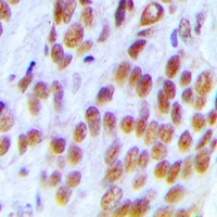 KDM1A Rabbit Polyclonal Antibody