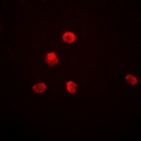 KDM1A Rabbit Polyclonal Antibody