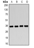 LDHA Rabbit Polyclonal Antibody