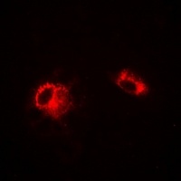 LDHA Rabbit Polyclonal Antibody