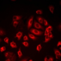 LITAF Rabbit Polyclonal Antibody