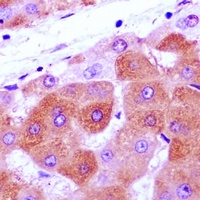 NRAGE Rabbit Polyclonal Antibody
