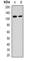 MALT1 Rabbit Polyclonal Antibody