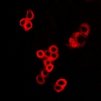 MALT1 Rabbit Polyclonal Antibody