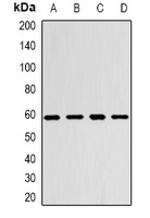 Monoamine Oxidase B Rabbit Polyclonal Antibody