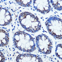 Monoamine Oxidase B Rabbit Polyclonal Antibody