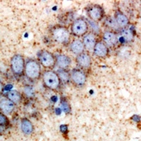 SAPK2 Rabbit Polyclonal Antibody