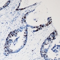JNK1 Rabbit Polyclonal Antibody