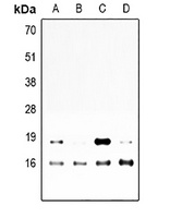 MBP Rabbit Polyclonal Antibody