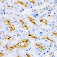 MBP Rabbit Polyclonal Antibody