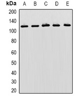 MBTPS1 Rabbit Polyclonal Antibody