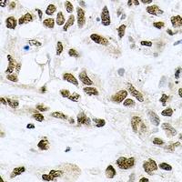 MCM6 Rabbit Polyclonal Antibody