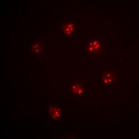 MCM6 Rabbit Polyclonal Antibody