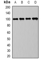 CD10 Rabbit Polyclonal Antibody