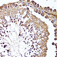 CD10 Rabbit Polyclonal Antibody