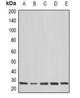 COX2 Rabbit Polyclonal Antibody
