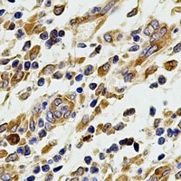 COX2 Rabbit Polyclonal Antibody