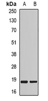 MYL2 Rabbit Polyclonal Antibody
