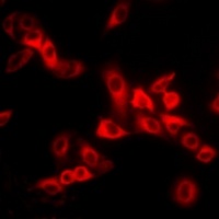 MYL2 Rabbit Polyclonal Antibody