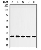 NDUFB5 Rabbit Polyclonal Antibody