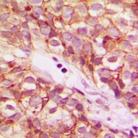 NDUFB5 Rabbit Polyclonal Antibody