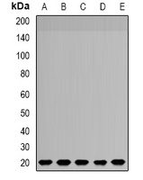 NDUFS4 Rabbit Polyclonal Antibody
