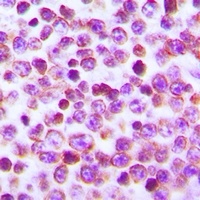 NFAT2 Rabbit Polyclonal Antibody