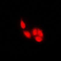 NFAT2 Rabbit Polyclonal Antibody