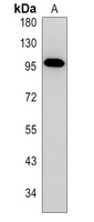 NFAT2 Rabbit Polyclonal Antibody