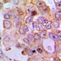 PDCD2L Rabbit Polyclonal Antibody