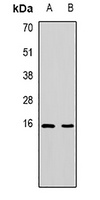 PDCD5 Rabbit Polyclonal Antibody