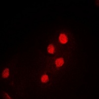 PDCD5 Rabbit Polyclonal Antibody