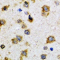 ProDynorphin Rabbit Polyclonal Antibody