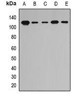 PITRM1 Rabbit Polyclonal Antibody