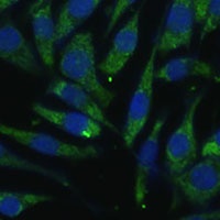 PITRM1 Rabbit Polyclonal Antibody