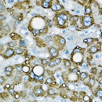 Adipophilin Rabbit Polyclonal Antibody