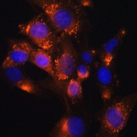 Adipophilin Rabbit Polyclonal Antibody