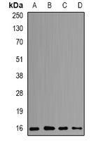 POLR2D Rabbit Polyclonal Antibody