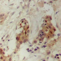 PRC1 Rabbit Polyclonal Antibody