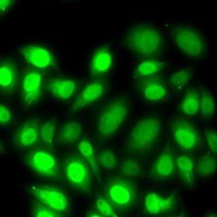 PRC1 Rabbit Polyclonal Antibody